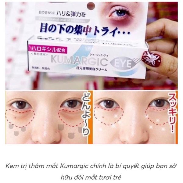 Kem trị thâm mắt Nhật Bản Kumargic 1