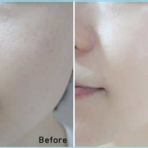 Nước thần dưỡng da SK – II Facial Treatment Essence 3