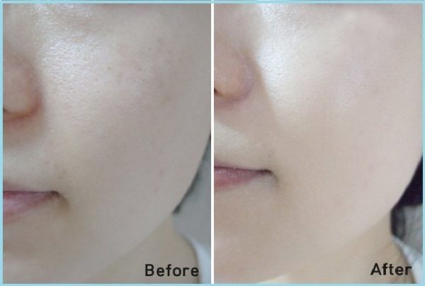 Nước thần dưỡng da SK – II Facial Treatment Essence 3